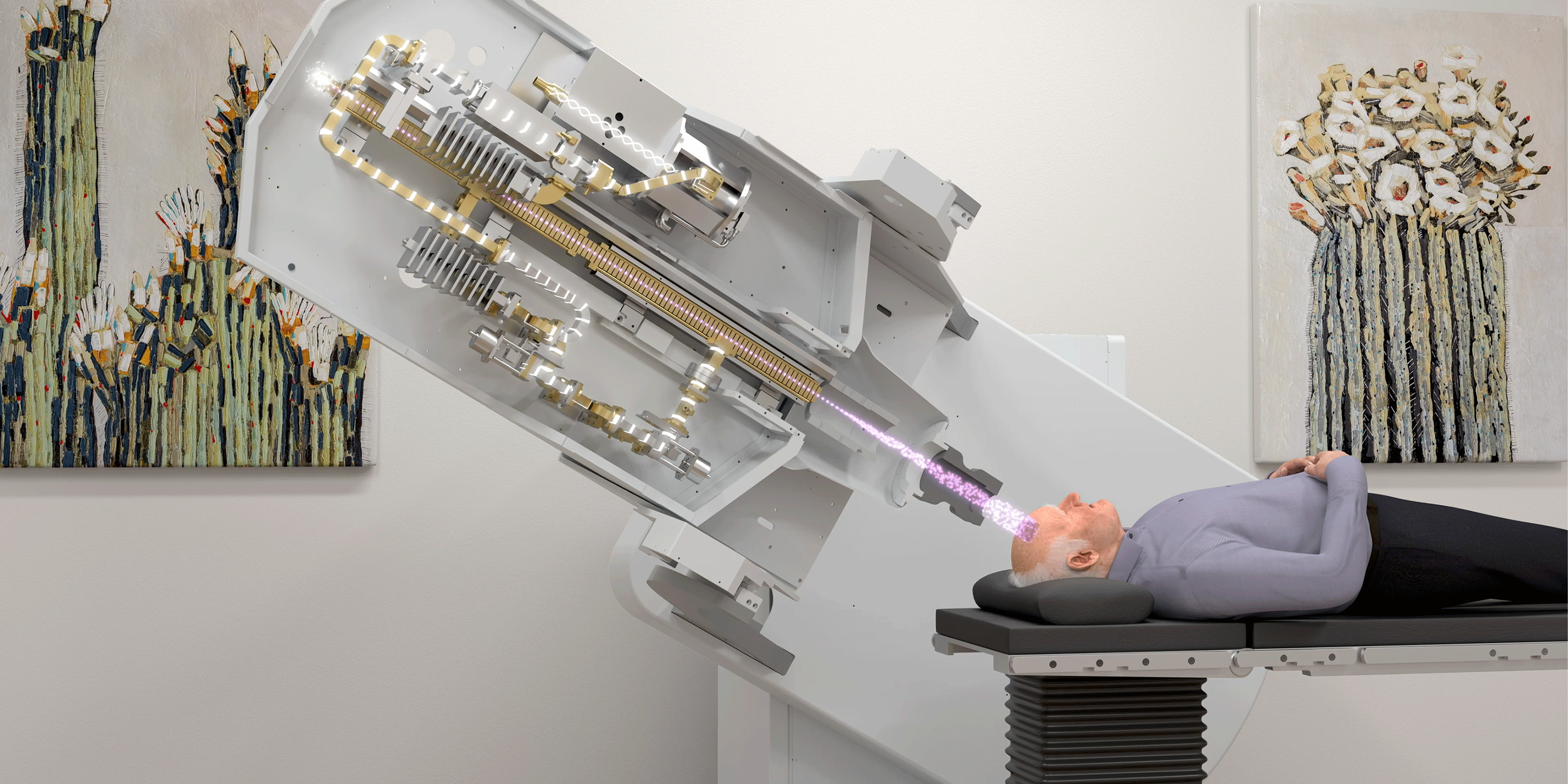 Man receiving Superficial Electron Therapy with Mobetron